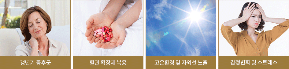안면홍조 원인