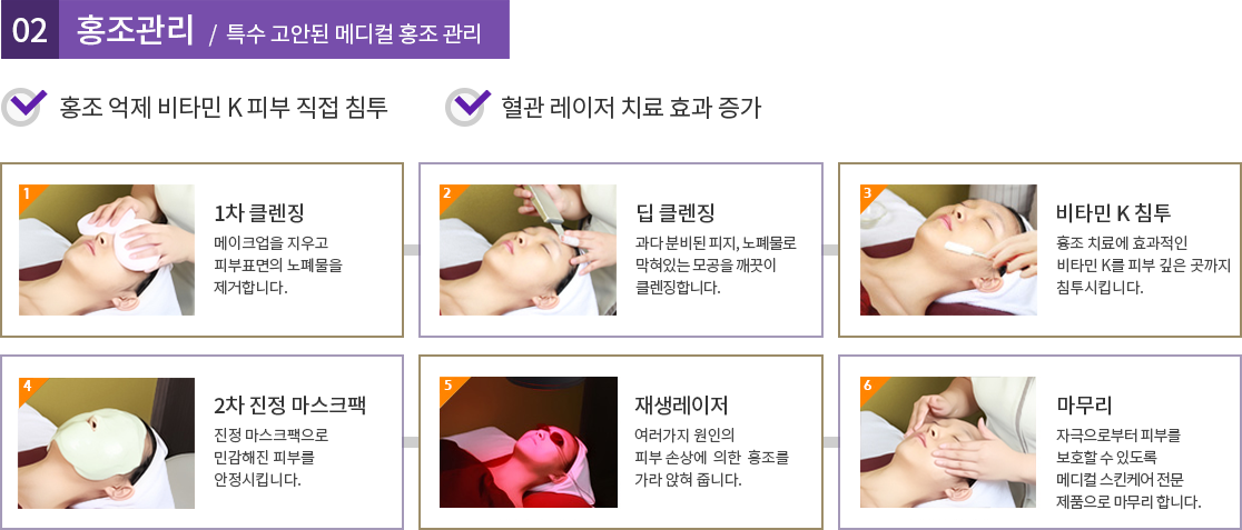 홍조 관리