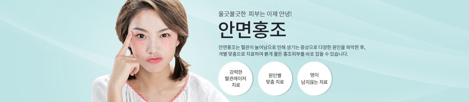 안면홍조